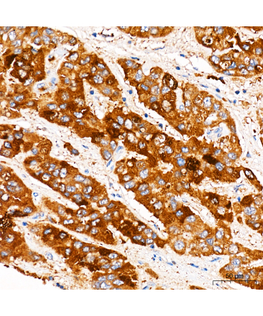 HMGCR Rabbit Polyclonal Antibody