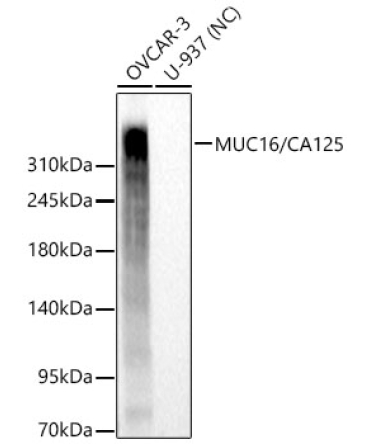 MUC16/CA125 Rabbit Monoclonal Antibody