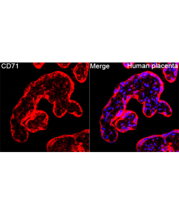 CD71 Rabbit Polyclonal Antibody