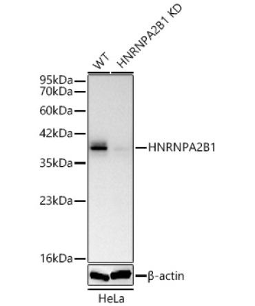 HNRNPA2B1 Rabbit Polyclonal Antibody [KD Validated]