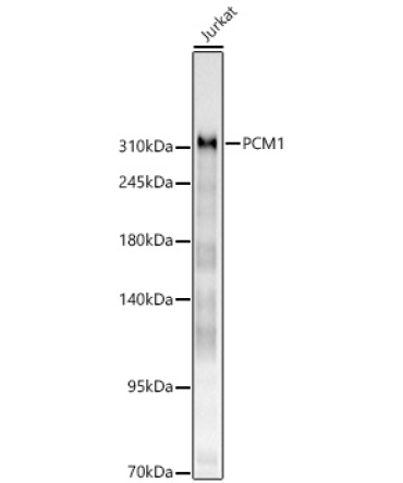PCM1 Rabbit Polyclonal Antibody