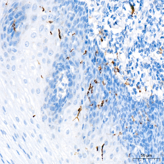 Langerin/CD207 Rabbit Polyclonal Antibody