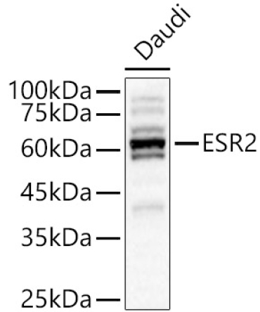 Estrogen Receptor beta Rabbit Polyclonal Antibody