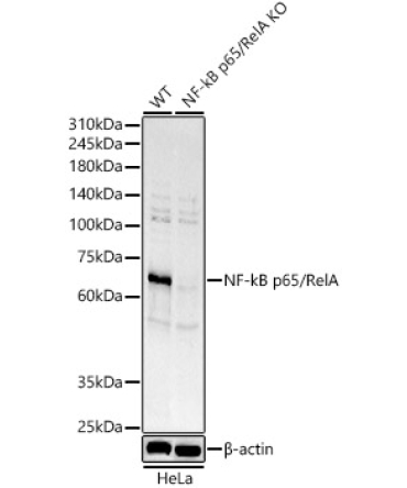 NF-kB p65/RelA Rabbit Polyclonal Antibody