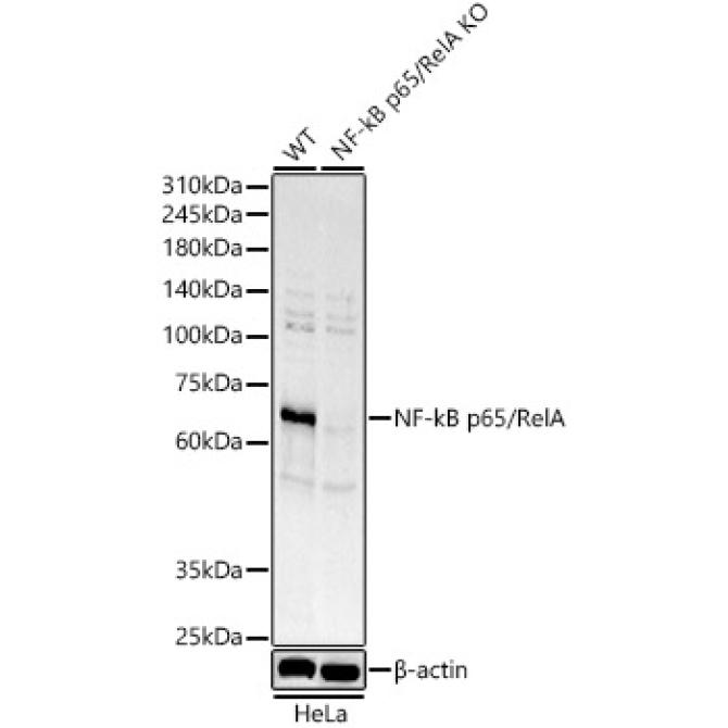 NF-kB p65/RelA Rabbit Polyclonal Antibody