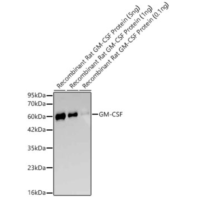 GM-CSF Rabbit Monoclonal Antibody
