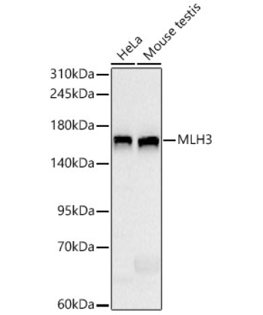 MLH3 Rabbit Monoclonal Antibody