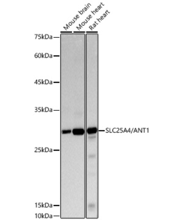 SLC25A4/ANT1 Rabbit Monoclonal Antibody [KO Validated]