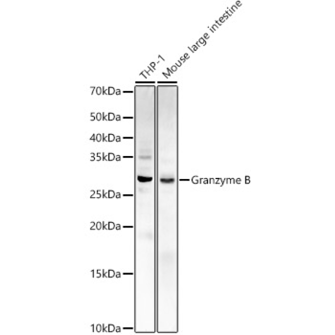 Granzyme B Rabbit Polyclonal Antibody