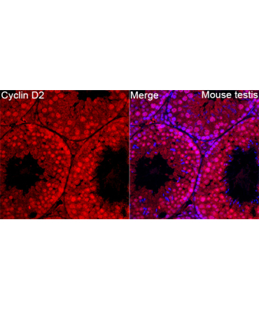 Cyclin D2 Rabbit Polyclonal Antibody