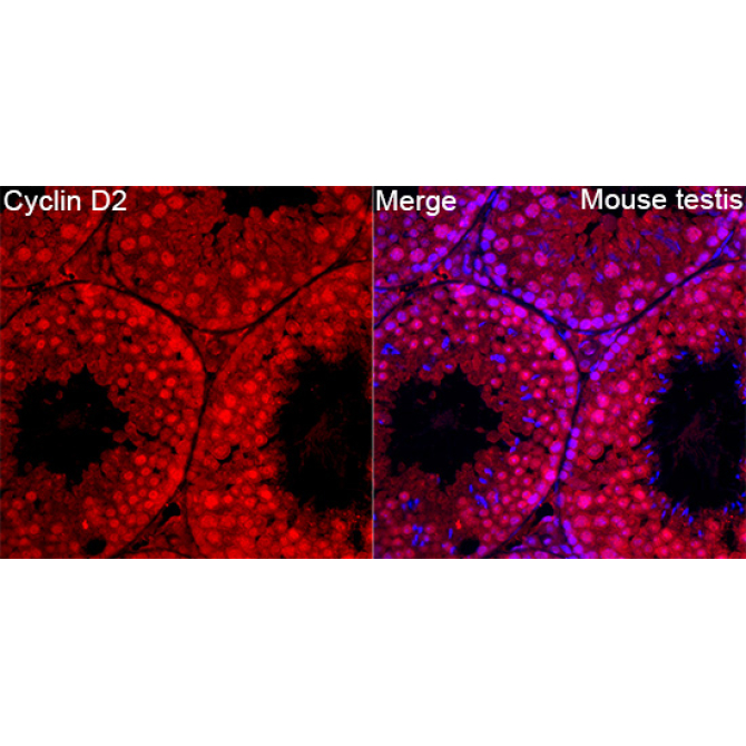 Cyclin D2 Rabbit Polyclonal Antibody