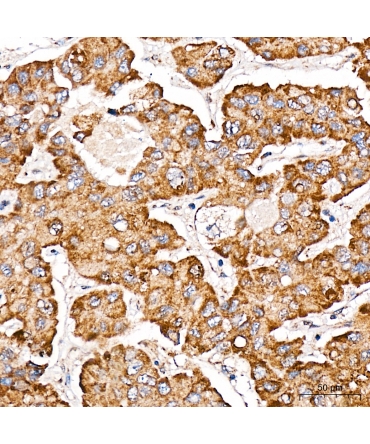 METTL4 Rabbit Polyclonal Antibody