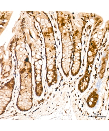 FOSL2/FRA2 Rabbit Polyclonal Antibody