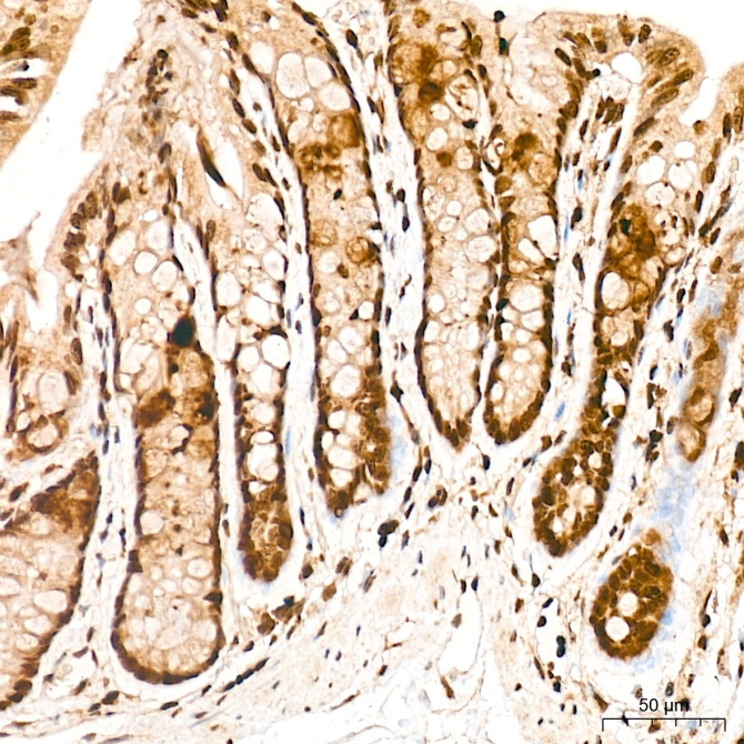FOSL2/FRA2 Rabbit Polyclonal Antibody