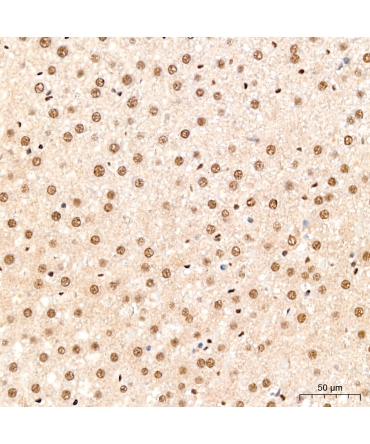 Fibrillarin/U3 RNP Rabbit Polyclonal Antibody