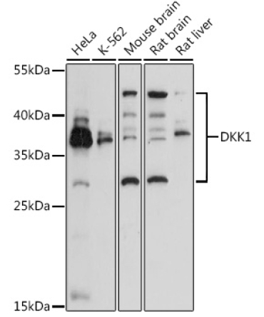 DKK1 Rabbit Polyclonal Antibody