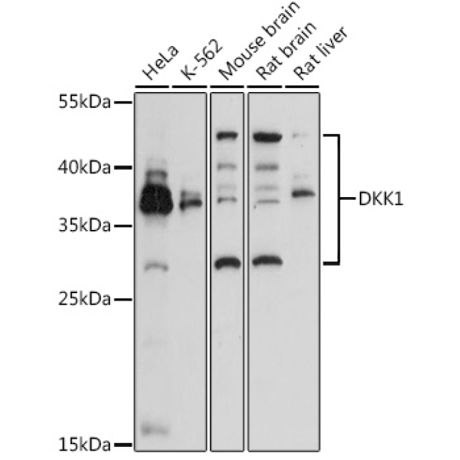 DKK1 Rabbit Polyclonal Antibody