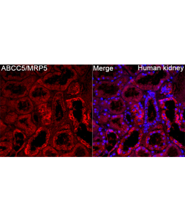 ABCC5/MRP5 Rabbit Polyclonal Antibody