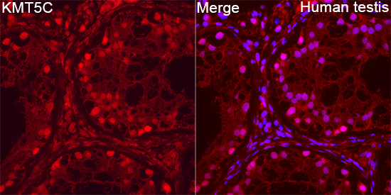 KMT5C Rabbit Polyclonal Antibody