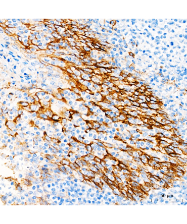 CD138 Rabbit Monoclonal Antibody