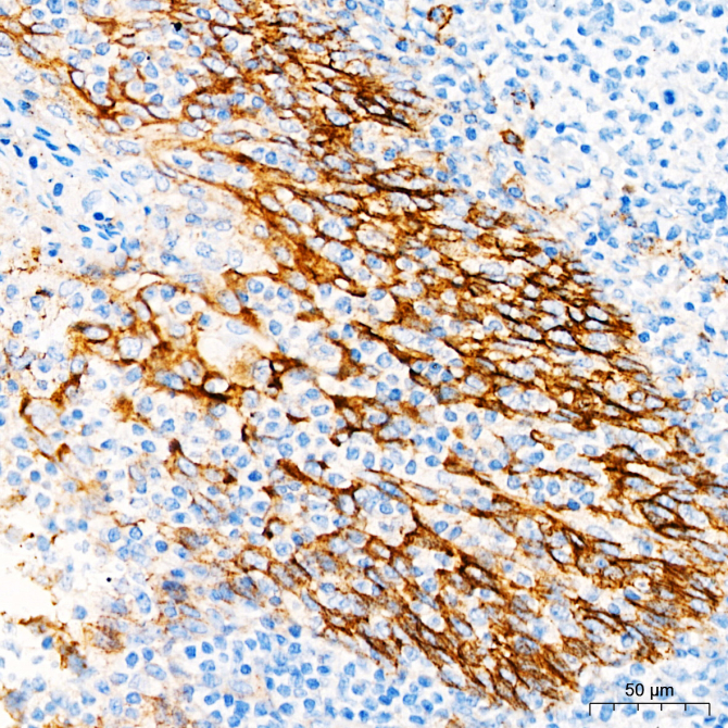 CD138 Rabbit Monoclonal Antibody