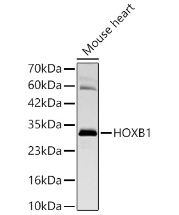 HOXB1 Rabbit Monoclonal Antibody