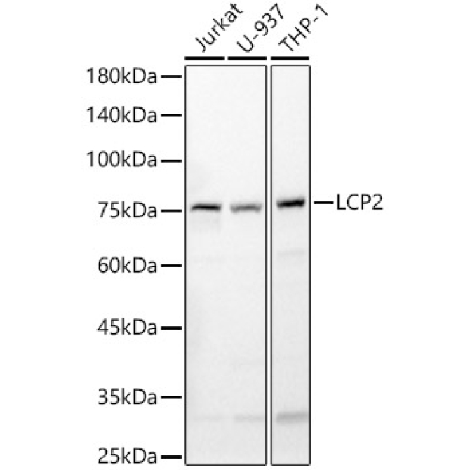 LCP2 Rabbit Polyclonal Antibody