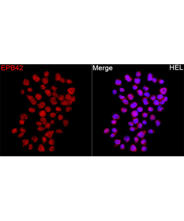 EPB42 Rabbit Polyclonal Antibody