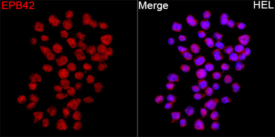 EPB42 Rabbit Polyclonal Antibody