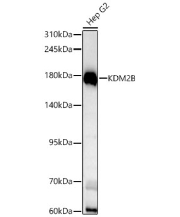 KDM2B Rabbit Polyclonal Antibody [KD Validated]
