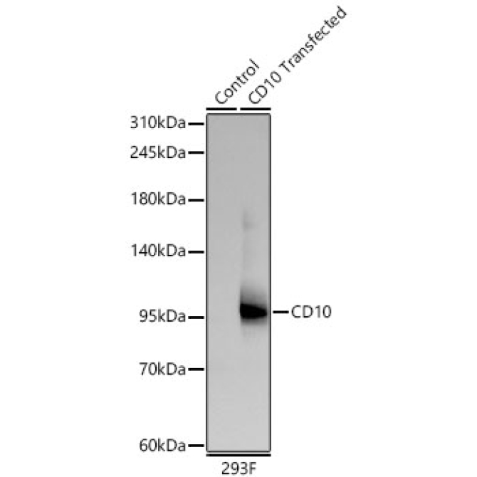 CD10 Rabbit Monoclonal Antibody
