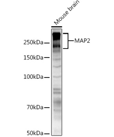 MAP2 Rabbit Polyclonal Antibody