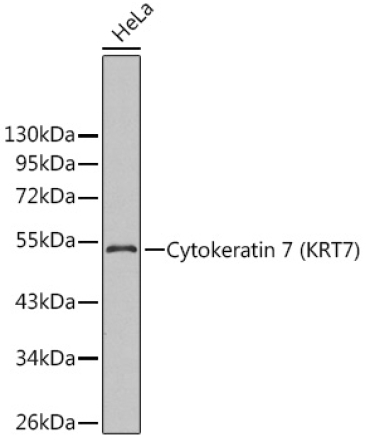 Cytokeratin 7 (KRT7) Rabbit Polyclonal Antibody