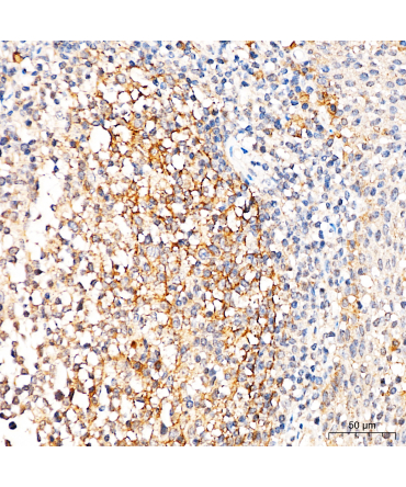 CD271 Rabbit Polyclonal Antibody