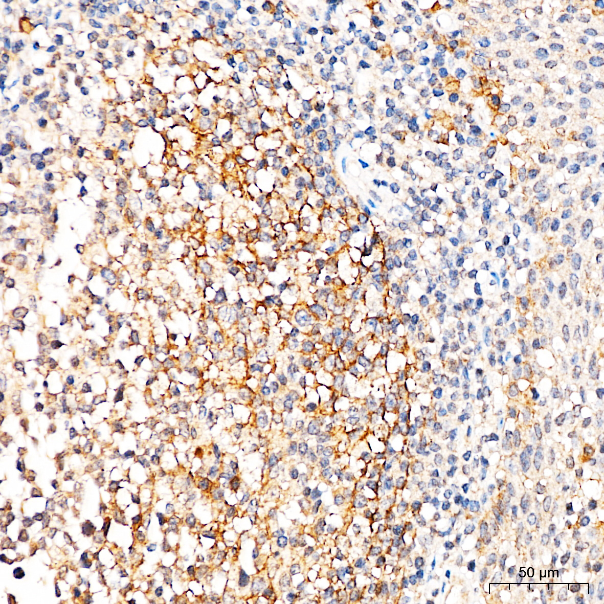 CD271 Rabbit Polyclonal Antibody