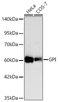 GPI Rabbit Polyclonal Antibody