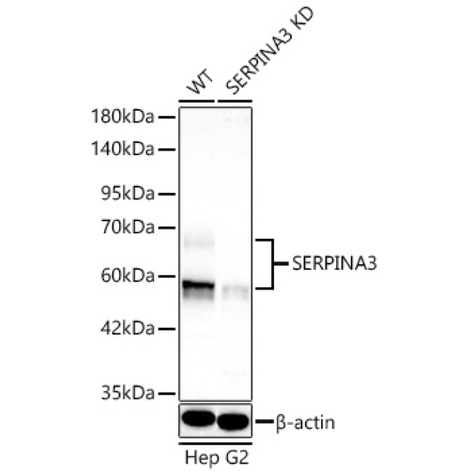 SERPINA3 Rabbit Polyclonal Antibody [KD Validated]