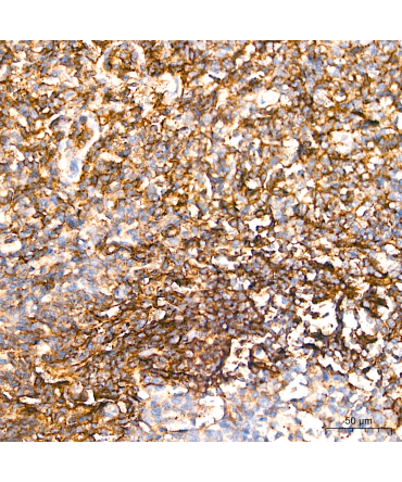 CD62L/L-Selectin Rabbit Polyclonal Antibody