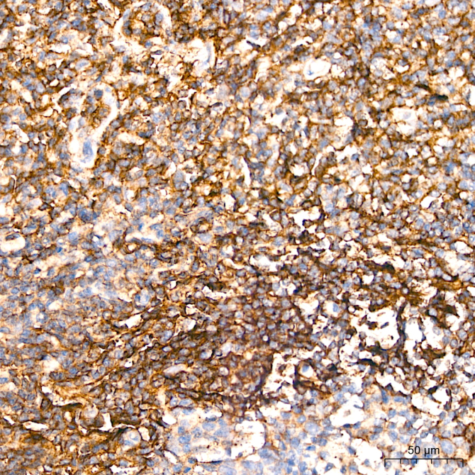 CD62L/L-Selectin Rabbit Polyclonal Antibody