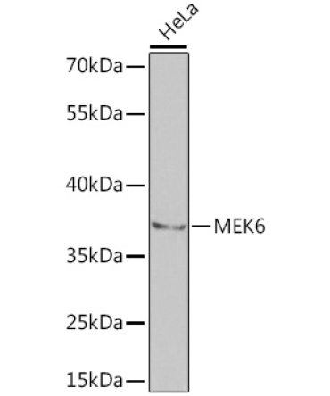 MEK6 Rabbit Polyclonal Antibody