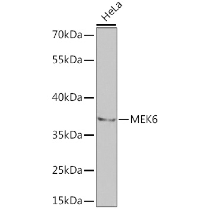 MEK6 Rabbit Polyclonal Antibody