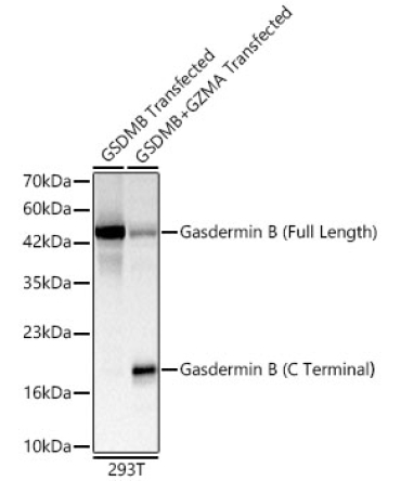 Gasdermin B ?Full Length+C terminal? Rabbit Polyclonal Antibody