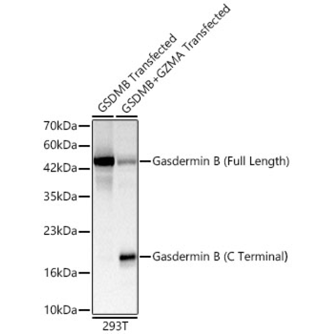 Gasdermin B ?Full Length+C terminal? Rabbit Polyclonal Antibody