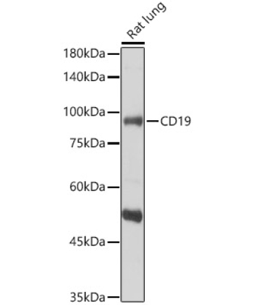 CD19 Rabbit Polyclonal Antibody
