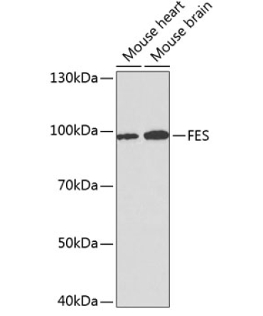 FES Rabbit Polyclonal Antibody