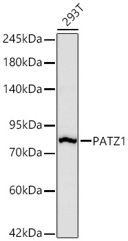 PATZ1 Rabbit Monoclonal Antibody