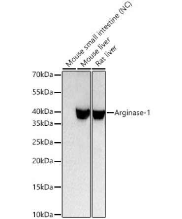 Arginase-1 Rabbit Monoclonal Antibody