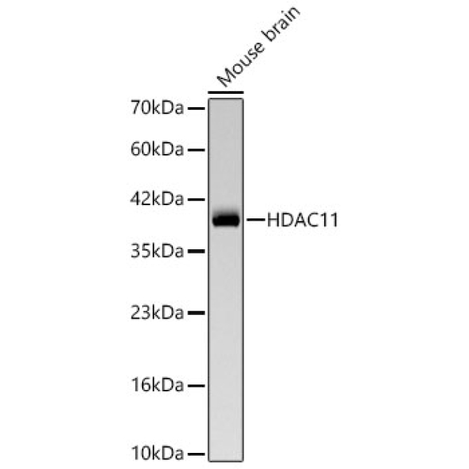 HDAC11 Rabbit Monoclonal Antibody