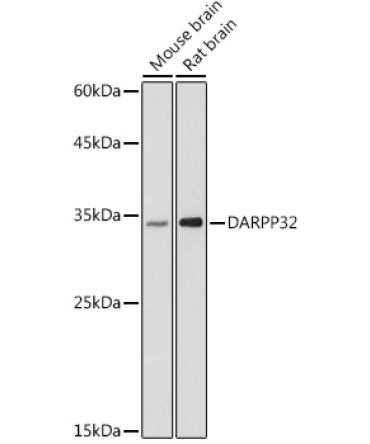 DARPP32 Rabbit Polyclonal Antibody