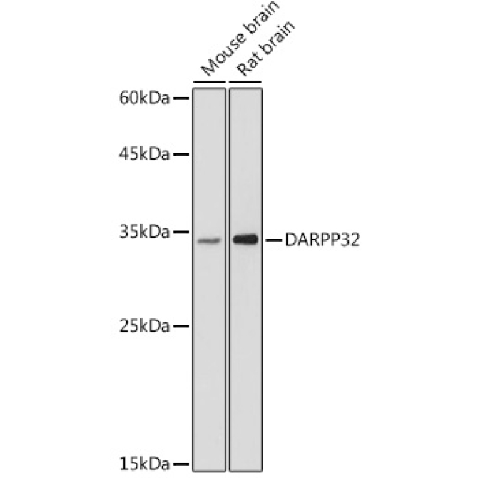 DARPP32 Rabbit Polyclonal Antibody